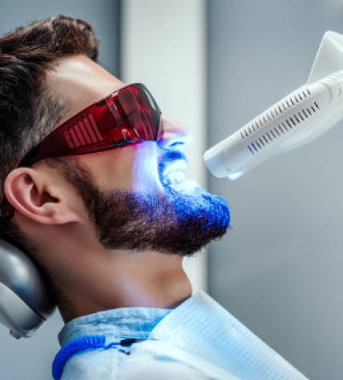 Unrecognizable dentist whitening teeth of young man sitting in dental chair in modern clinic. Side view.